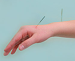 needles in hand